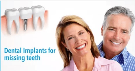 dental-implant